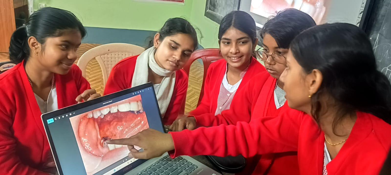 Four students gather around a screen showing the inside of a person's mouth.